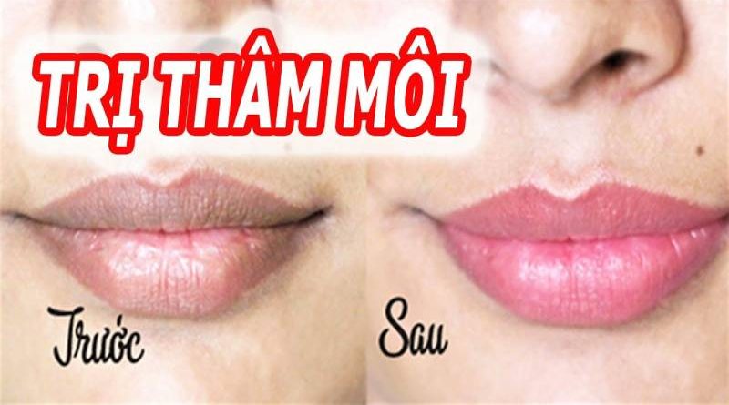 Cách trị thâm môi bằng kem đánh răng 11