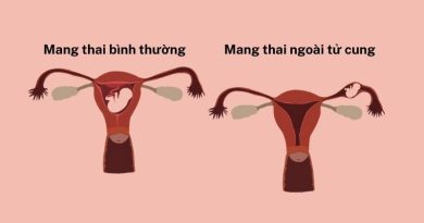 Dấu hiệu mang thai ngoài tử cung: Nguyên nhân, cách phòng tránh 4