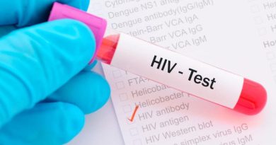 Dấu hiệu nhiễm HIV ở nam giới theo từng giai đoạn mà bạn nên biết 3