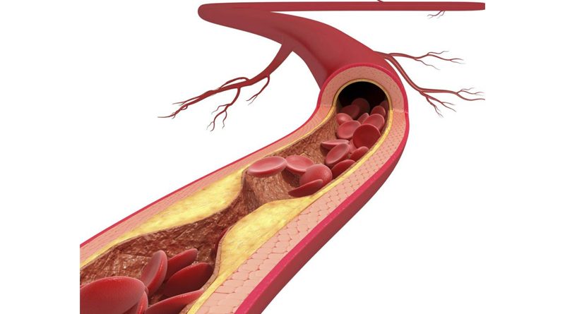 Lợi ích và những điều cần lưu ý khi ăn cá ngừ để tránh ngộ độc 1