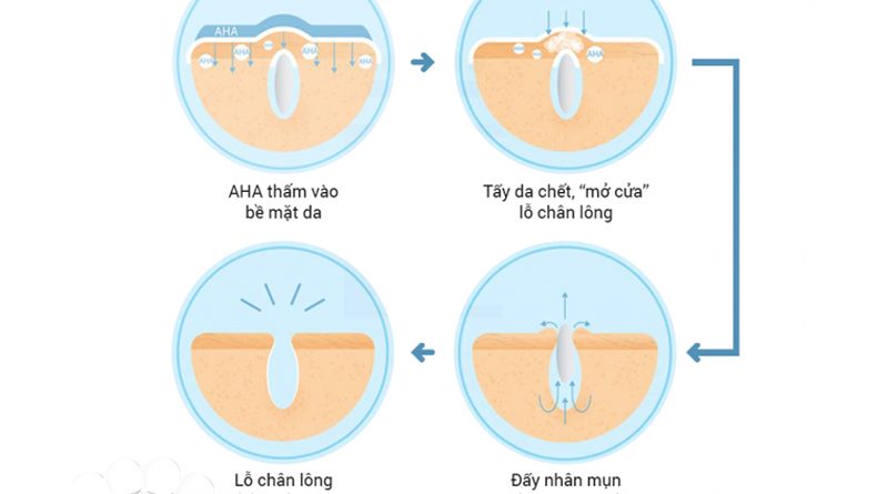 Mách bạn cách sử dụng AHA đúng chuẩn 9