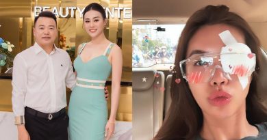 Thông tin đám cưới của Phương Oanh và Shark Bình, Minh Tú bị thương ở mắt 6