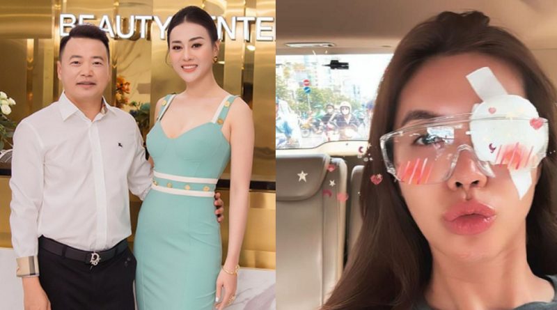 Thông tin đám cưới của Phương Oanh và Shark Bình, Minh Tú bị thương ở mắt 1